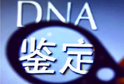 曲靖司法亲子鉴定需要什么手续，曲靖司法DNA鉴定预约办理