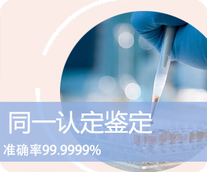 曲靖DNA同一认定