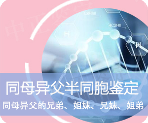 曲靖同母异父半同胞鉴定